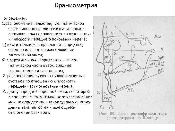 Краниометрия определяет: 1. расположение челюстей, т. е. гнатической части лицевого скелета в сагиттальном и