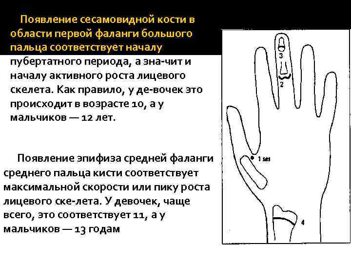  Появление сесамовидной кости в области первой фаланги большого пальца соответствует началу пубертатного периода,