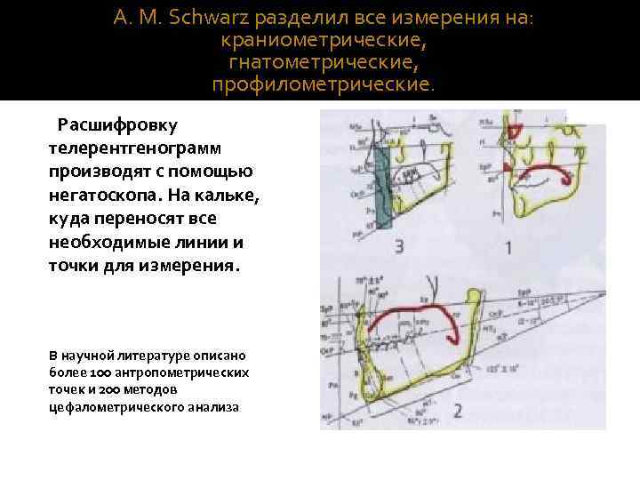 А. М. Schwarz разделил все измерения на: краниометрические, гнатометрические, профилометрические. Расшифровку телерентгенограмм производят с