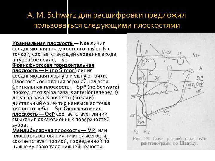 А. М. Schwarz для расшифровки предложил пользоваться следующими плоскостями Краниальная плоскость — Nse линия