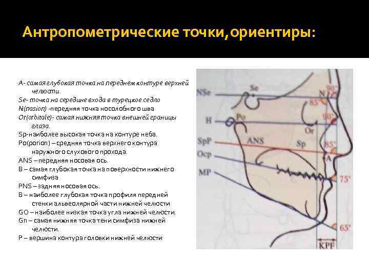 Антропометрические точки, ориентиры: А- самая глубокая точка на переднем контуре верхней челюсти Se- точка