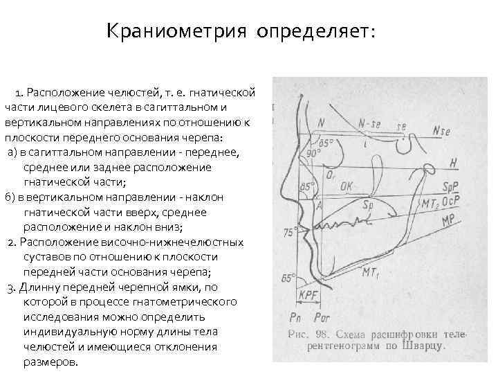 Краниометрия определяет: 1. Расположение челюстей, т. е. гнатической части лицевого скелета в сагиттальном и