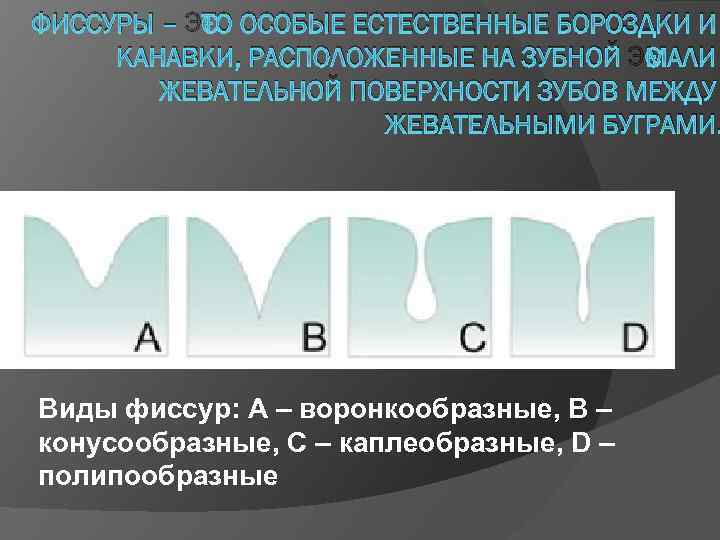 ФИССУРЫ – ЭТО ОСОБЫЕ ЕСТЕСТВЕННЫЕ БОРОЗДКИ И КАНАВКИ, РАСПОЛОЖЕННЫЕ НА ЗУБНОЙ ЭМАЛИ ЖЕВАТЕЛЬНОЙ ПОВЕРХНОСТИ
