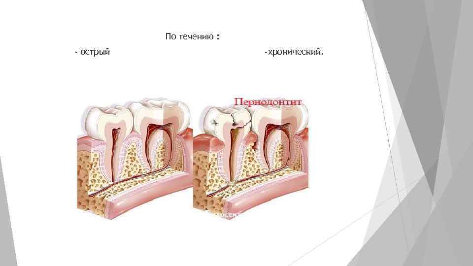 По течению : - острый -хронический. 