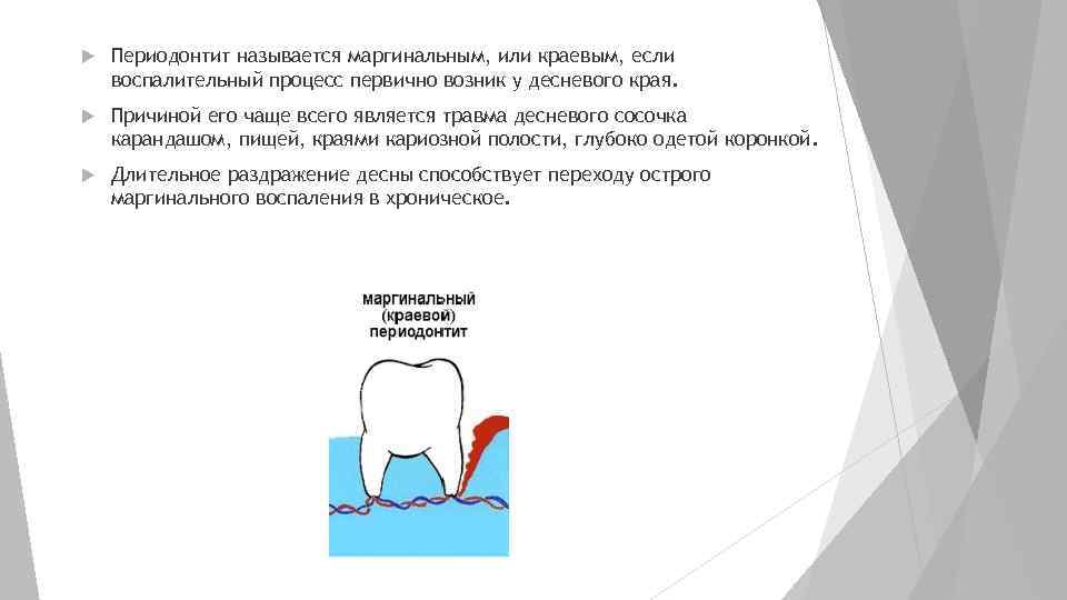  Периодонтит называется маргинальным, или краевым, если воспалительный процесс первично возник у десневого края.