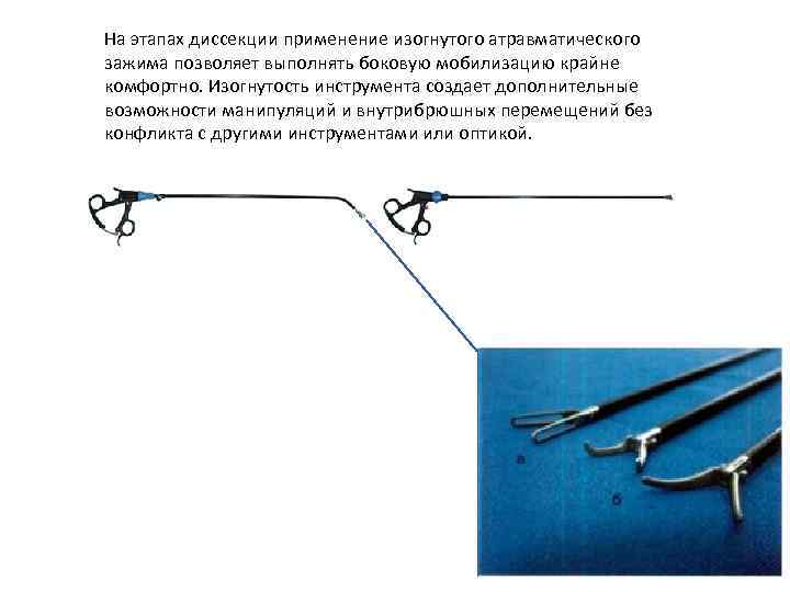 На этапах диссекции применение изогнутого атравматического зажима позволяет выполнять боковую мобилизацию крайне комфортно. Изогнутость