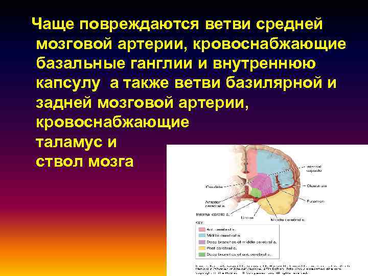  Чаще повреждаются ветви средней мозговой артерии, кровоснабжающие базальные ганглии и внутреннюю капсулу а