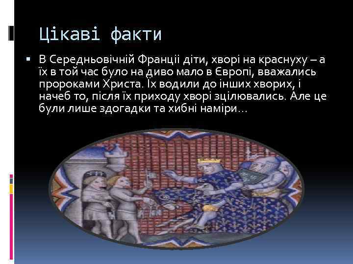 Цікаві факти В Середньовічній Франціі діти, хворі на краснуху – а їх в той