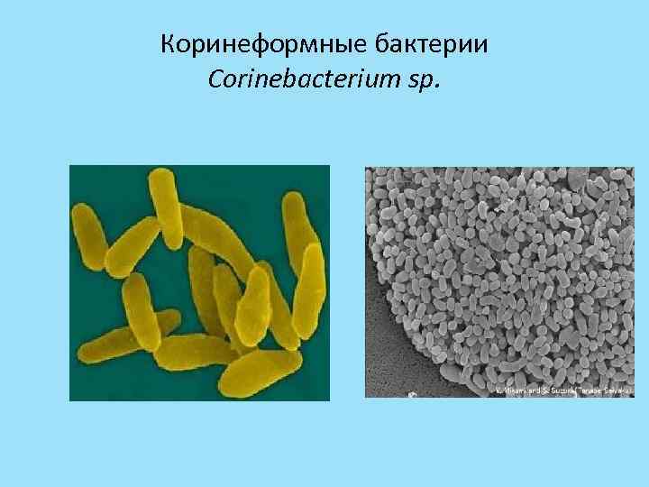 Коринеформные бактерии Corinebacterium sp. 