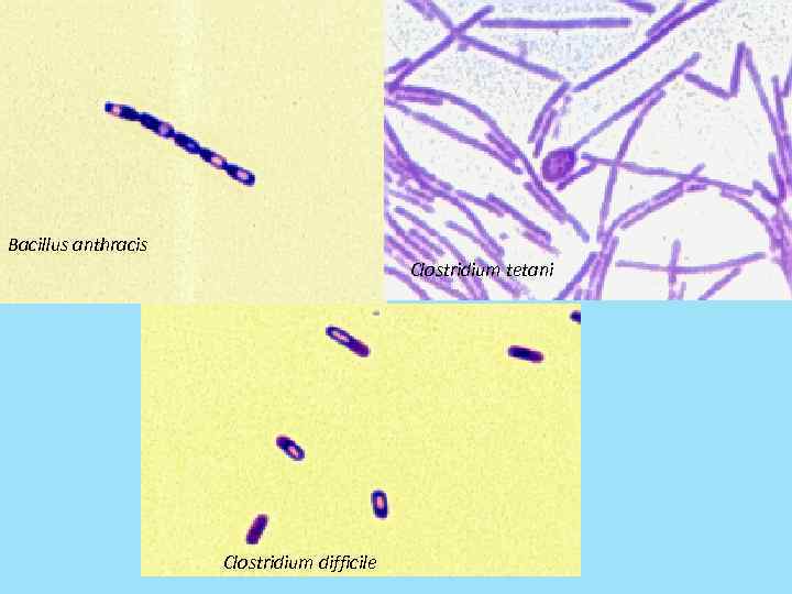 Bacillus anthracis Clostridium tetani Clostridium difficile 