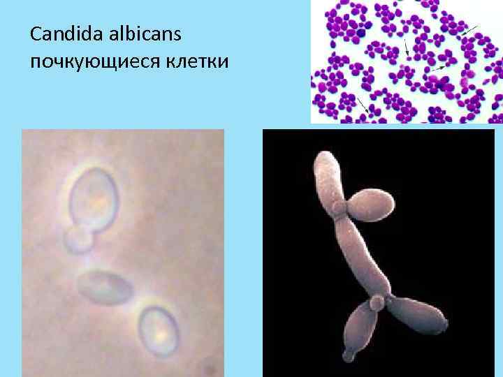Candida albicans почкующиеся клетки 