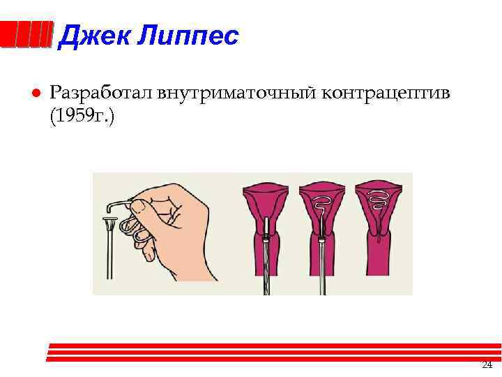 Джек Липпес l Разработал внутриматочный контрацептив (1959 г. ) 24 