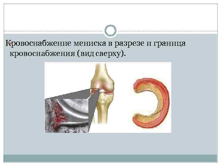 Кровоснабжение мениска в разрезе и граница • кровоснабжения (вид сверху). 