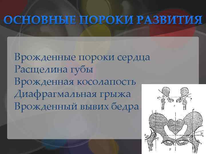 ОСНОВНЫЕ ПОРОКИ РАЗВИТИЯ Врожденные пороки сердца Расщелина губы Врожденная косолапость Диафрагмальная грыжа Врожденный вывих