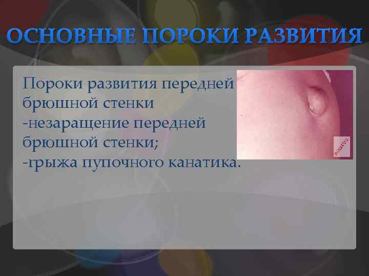 ОСНОВНЫЕ ПОРОКИ РАЗВИТИЯ Пороки развития передней брюшной стенки -незаращение передней брюшной стенки; -грыжа пупочного