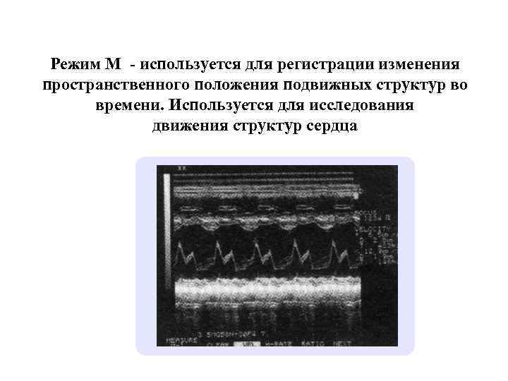 Режим М - используется для регистрации изменения пространственного положения подвижных структур во времени. Используется