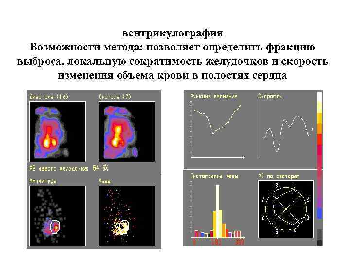 Методы лучевого исследования сердца и сосудов презентация