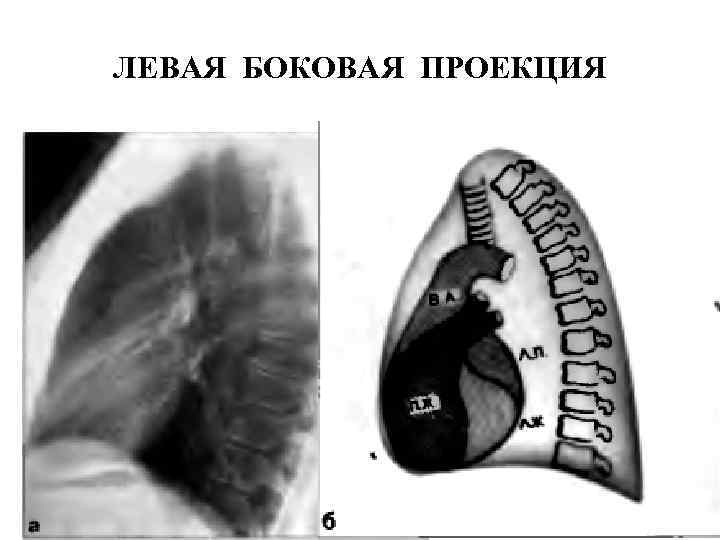 ЛЕВАЯ БОКОВАЯ ПРОЕКЦИЯ 