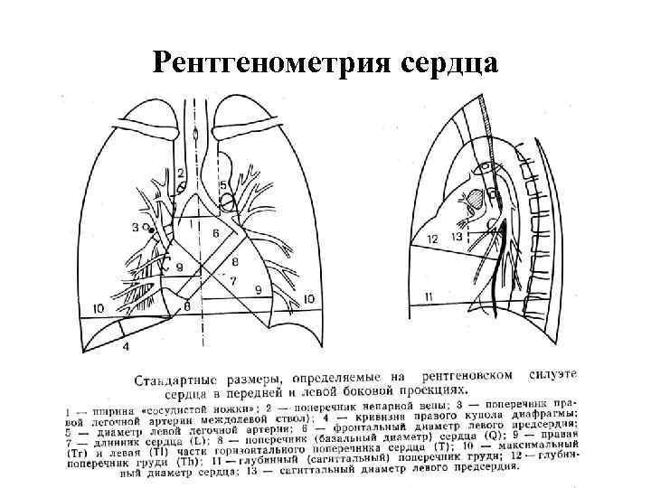 Рентгенометрия сердца 