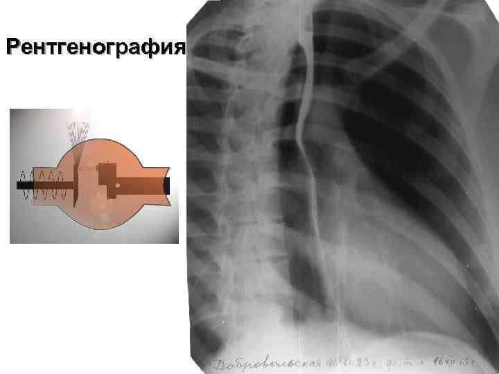 Рентгенография 