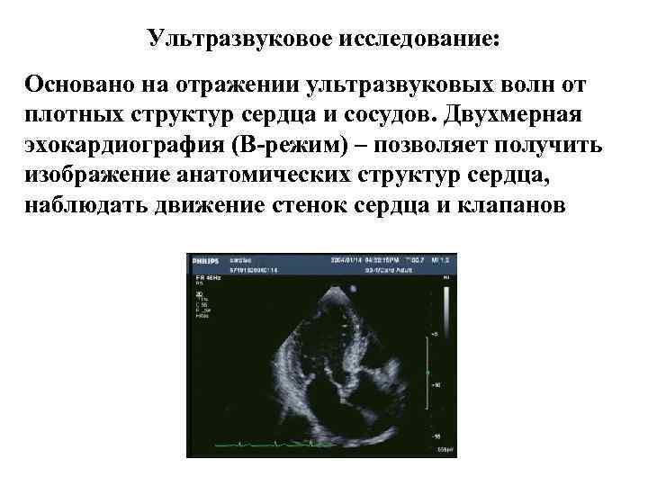 Методы лучевого исследования сердца и сосудов презентация