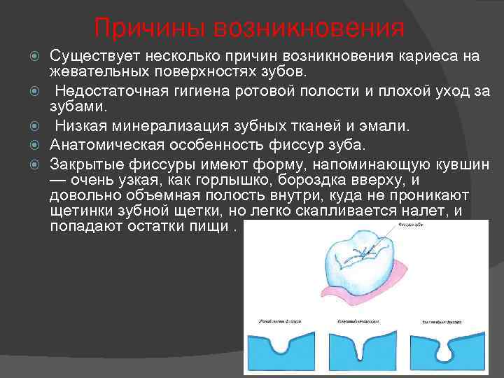 Гигиенические индексы в стоматологии