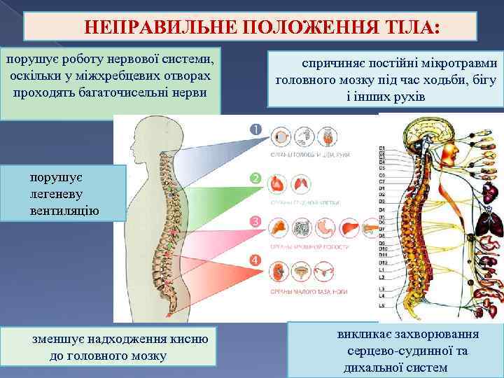 НЕПРАВИЛЬНЕ ПОЛОЖЕННЯ ТІЛА: порушує роботу нервової системи, оскільки у міжхребцевих отворах проходять багаточисельні нерви