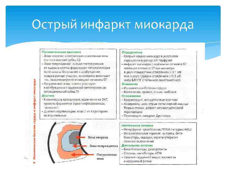 Острый инфаркт миокарда 