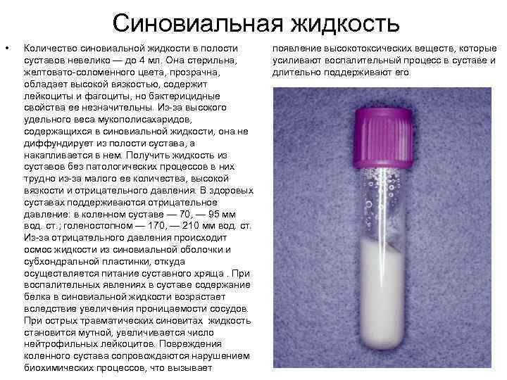 Как будет жидкость. Состав синовиальной жидкости. Суставная жидкость состав. Цвет синовиальной жидкости. Исследование синовиальной жидкости коленного сустава.