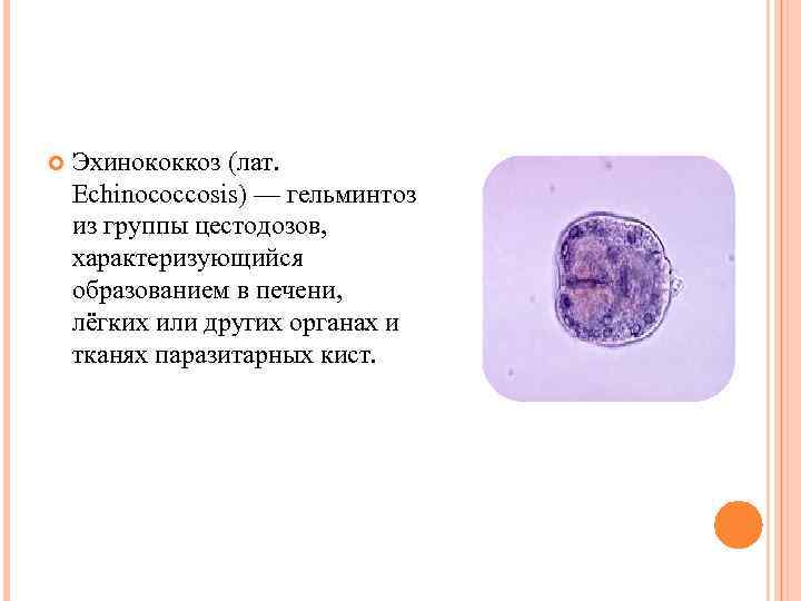  Эхинококкоз (лат. Echinococcosis) — гельминтоз из группы цестодозов, характеризующийся образованием в печени, лёгких