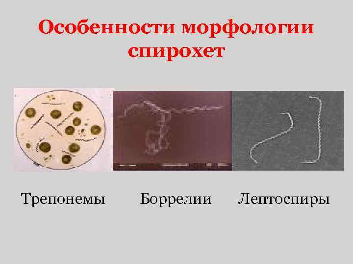 Особенности морфологии спирохет Трепонемы Боррелии Лептоспиры 