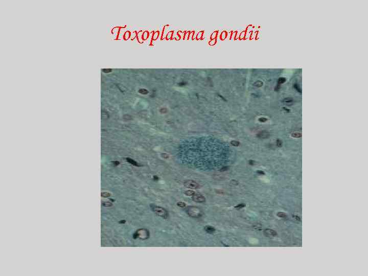 Toxoplasma gondii 