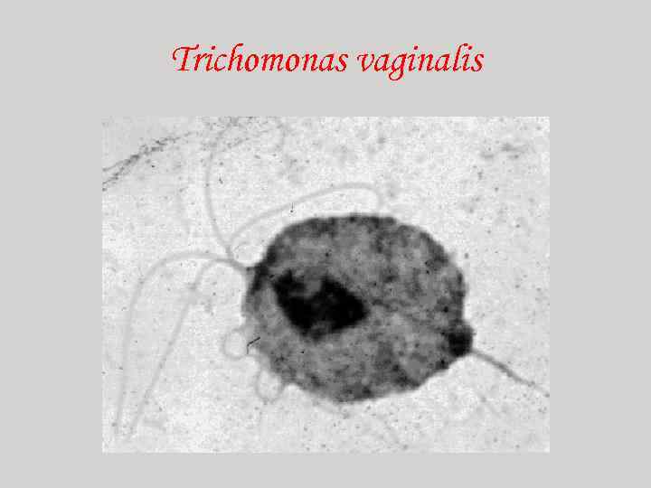 Trichomonas vaginalis 
