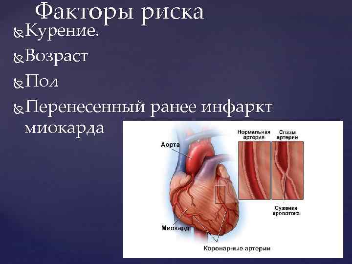 Факторы риска Курение. Возраст Пол Перенесенный ранее инфаркт миокарда 