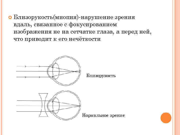 От чего зависит размер изображения получаемого на сетчатке