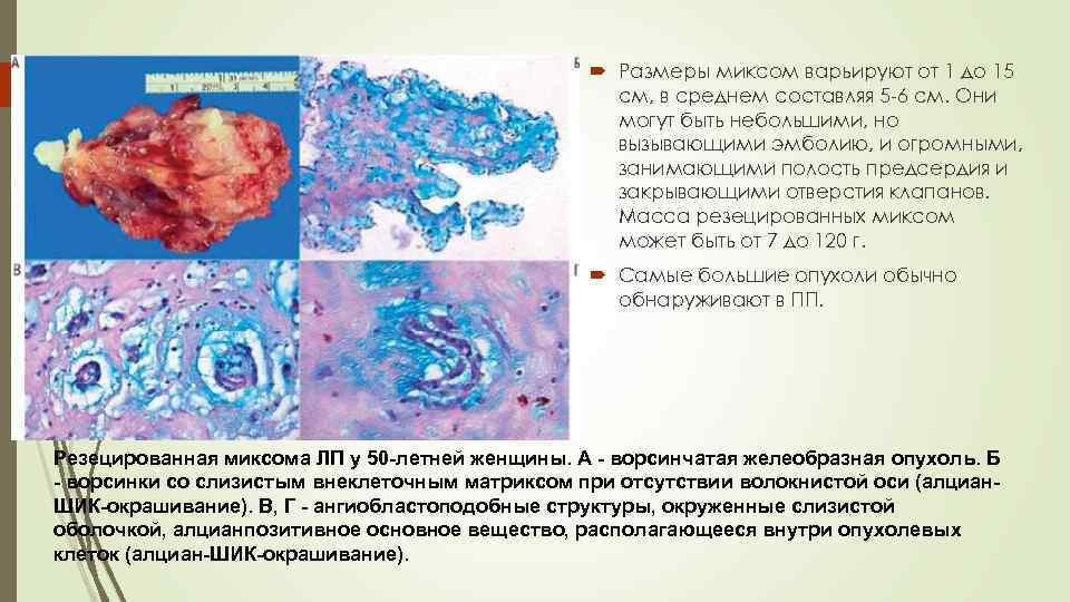  Размеры миксом варьируют от 1 до 15 см, в среднем составляя 5 -6