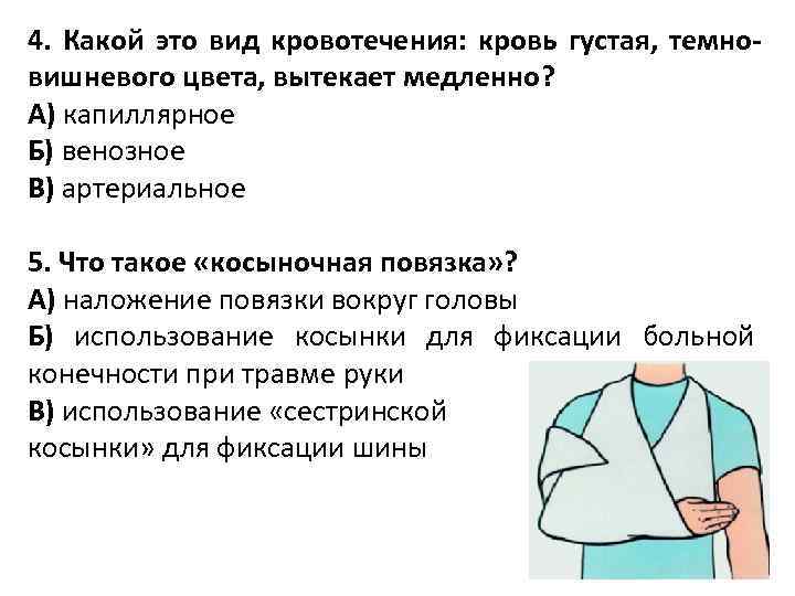 4. Какой это вид кровотечения: кровь густая, темновишневого цвета, вытекает медленно? А) капиллярное Б)