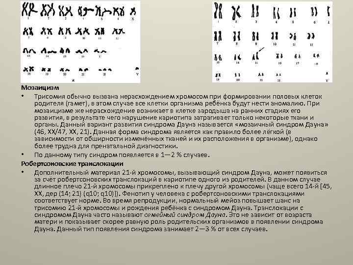Кариотип синдрома дауна. Мозаичная форма синдрома Дауна кариотип. Механизм возникновения мозаичной формы синдрома Дауна. Мозаичный кариотип.