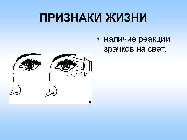 ПРИЗНАКИ ЖИЗНИ • наличие реакции зрачков на свет. 