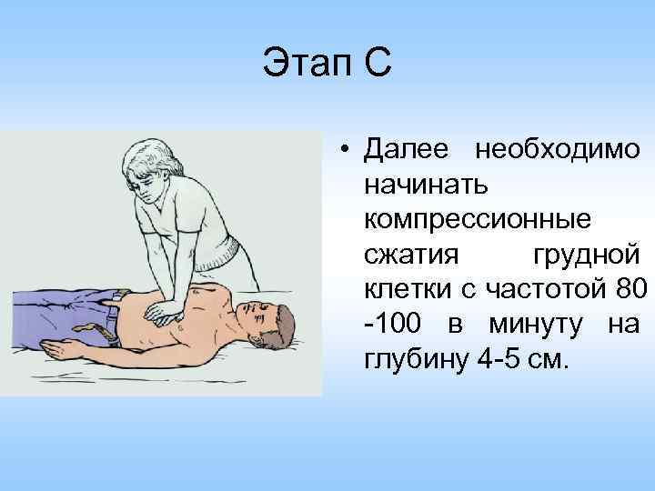 Этап С • Далее необходимо начинать компрессионные сжатия грудной клетки с частотой 80 -100