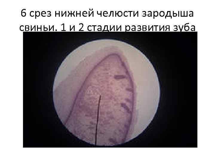 6 срез нижней челюсти зародыша свиньи. 1 и 2 стадии развития зуба 