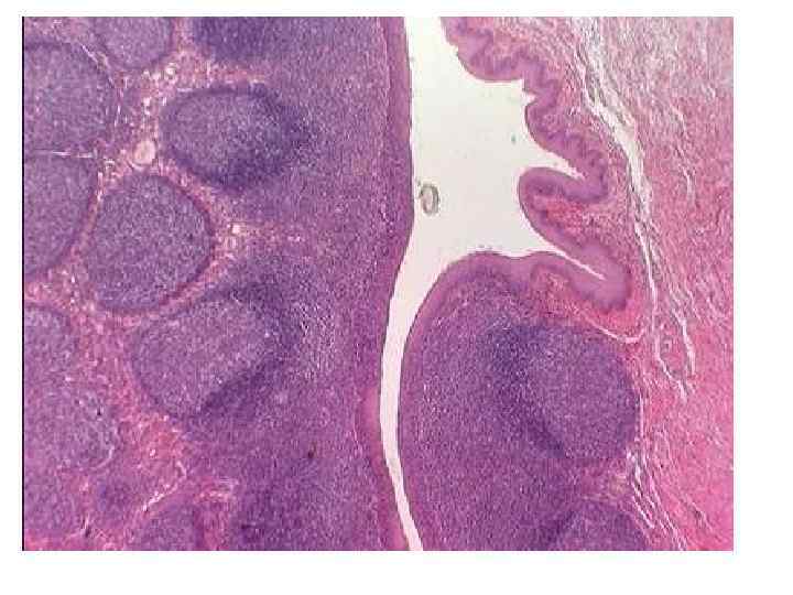 Небная миндалина гистология рисунок