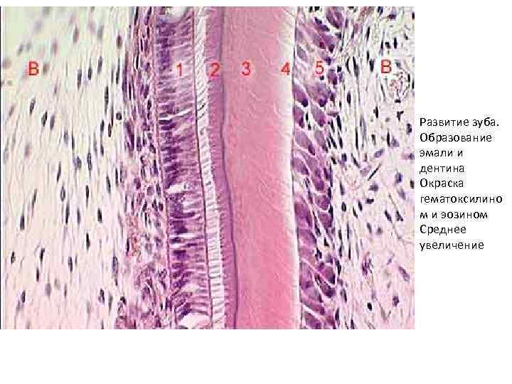 Развитие зуба. Образование эмали и дентина Окраска гематоксилино м и эозином Среднее увеличение 