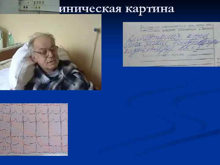 Клиническая картина 