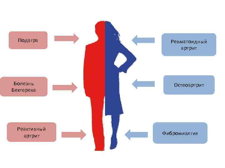 Подагра Болезнь Бехтерева Реактивный артрит Ревматоидный артрит Остеоартрит Фибромиалгия 