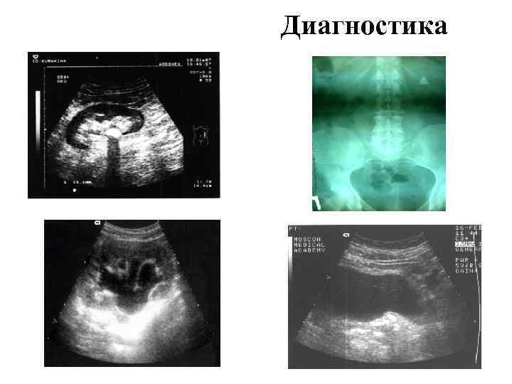 Диагностика 