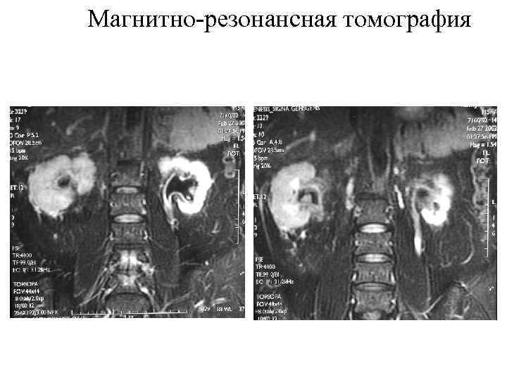 Магнитно-резонансная томография 
