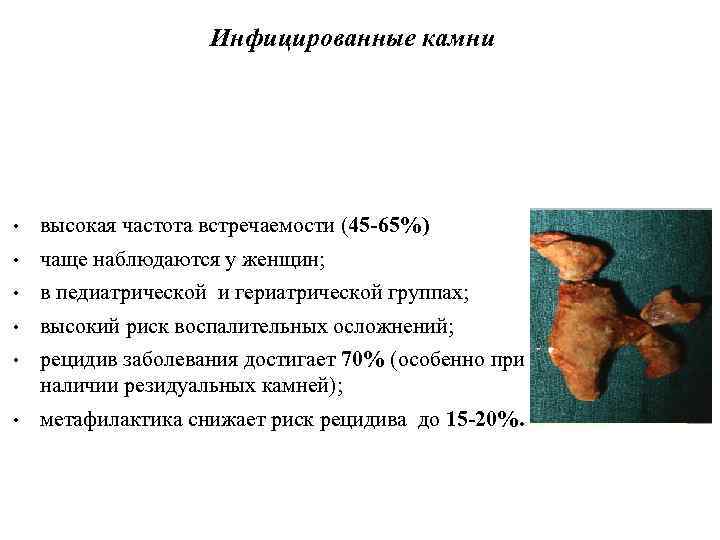 Инфицированные камни • высокая частота встречаемости (45 -65%) • чаще наблюдаются у женщин; •