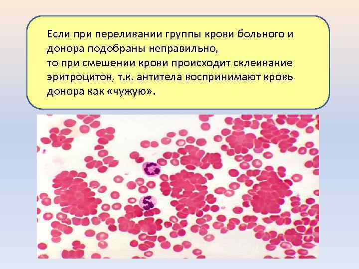 Если при переливании группы крови больного и донора подобраны неправильно, то при смешении крови