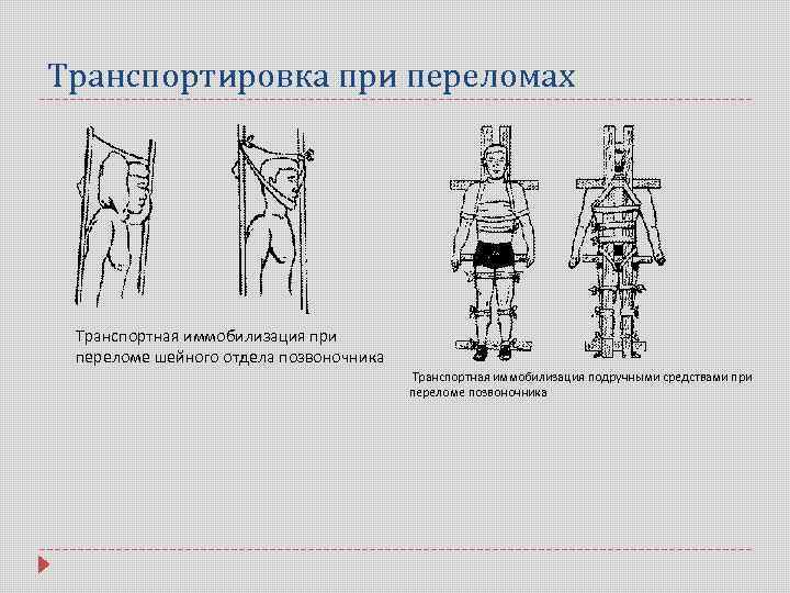 Транспортная иммобилизация шейный отдел позвоночника